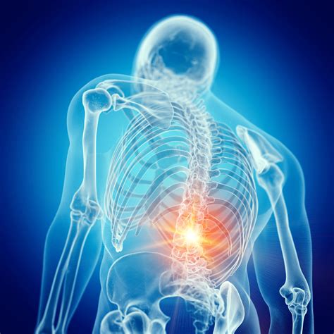 Lower Back Pain