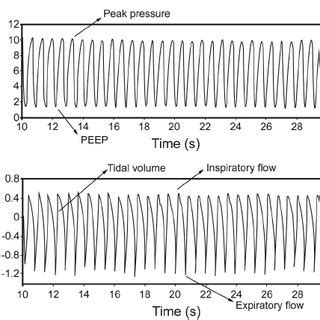 Typical pressure curves of the 3 intrapulmonary percussive ventilation ...
