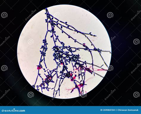 Malassezia Yeast Cytology Of Human Epidermis Royalty Free Stock