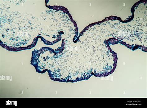 Lichen Cross Section Hi Res Stock Photography And Images Alamy