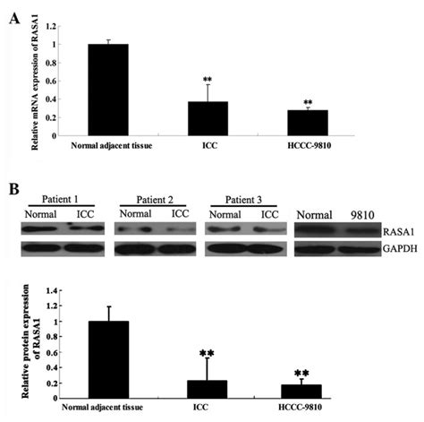 Mrna And Protein Expression Of Ras P Gtpase Activating Protein