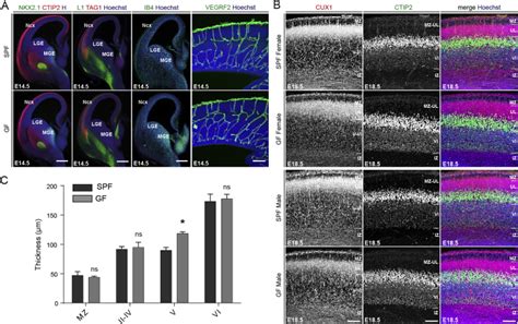 Microbiome Influences Prenatal And Adult Microglia In A Sex Specific