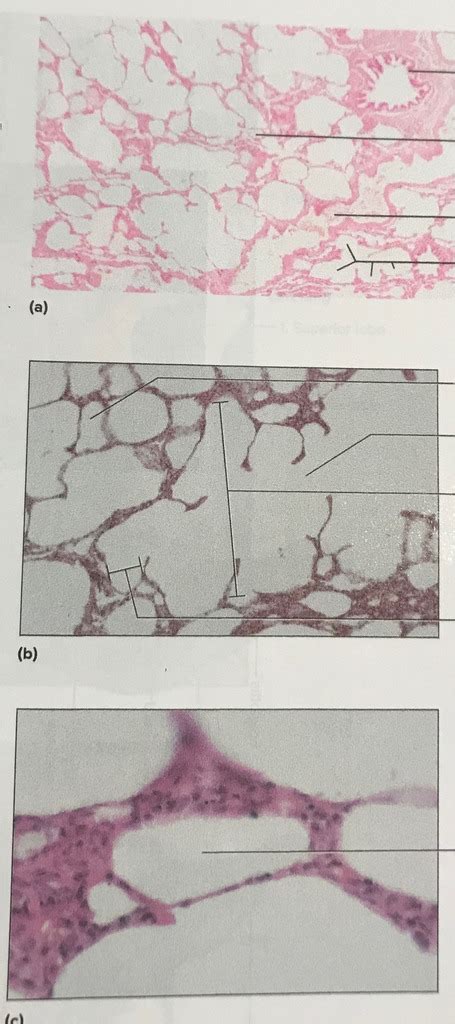 Normal Lung Slide