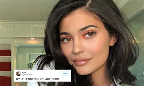 This Photo Of Kylie Jenner Without Lip Filler Has Fans So Surprised