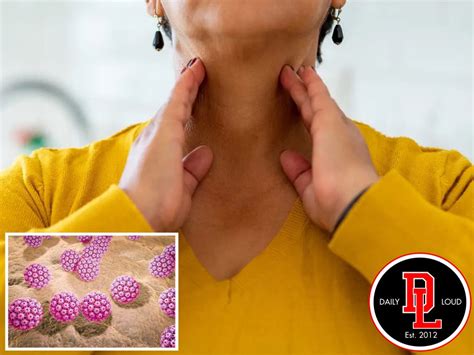 Daily Loud On Twitter According To Experts Oral Sex May Now Lead To Throat Cancer