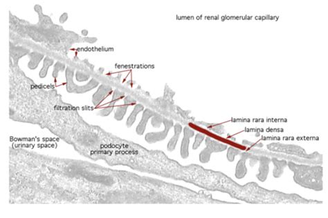 Interstitial Renal Disease Flashcards | Quizlet