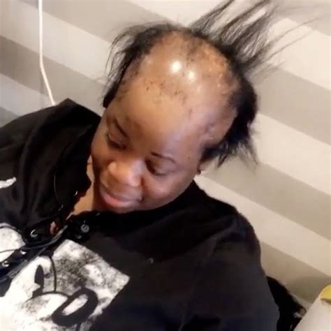hairstyle  cover bald spot woman