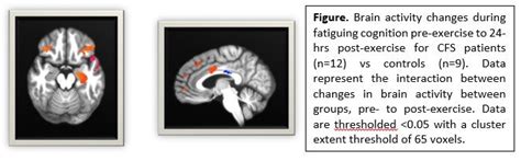 Deciphering Post-Exertional Malaise - Solve ME/CFS Initiative