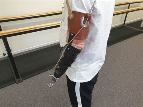 Upper Limb Prosthetics Ability Prosthetics And Orthotics