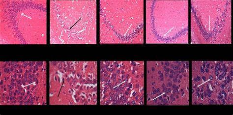 Histopathological changes of CA 3 region of hippocampus. H & E stained ... 