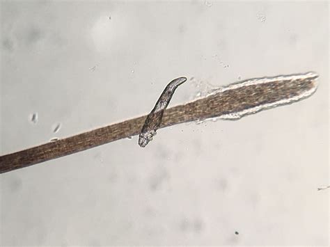 Demodex - Your Vet Wants You to Know