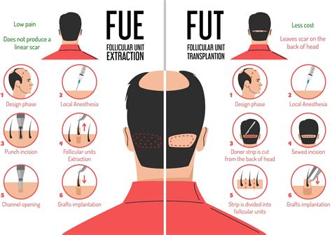 Hair Transplant - Halnikar Hospital