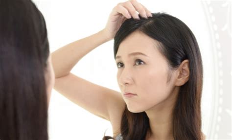 夕方になると頭皮がべたつく？原因とおすすめの対処法とは 【髪塾】hairs School