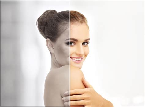 Premium Photo Dark Spots Freckles Hyperpigmentation Melasma Or