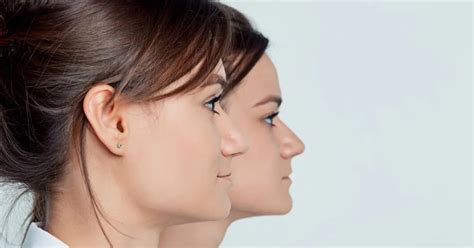 The Supermodel Secret for the Sharpest Jawline - Crispme