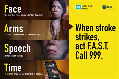 If You Suspect A Stroke Act F A S T Gpsurgery Net Websites For Nhs