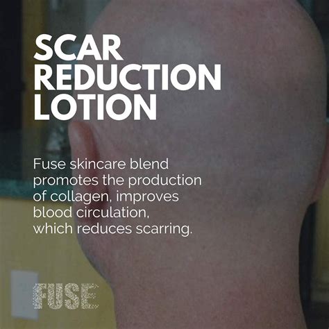 Scalp Micropigmentation Aftercare Lotion Anti Shine Fragrance Free