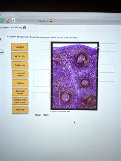 SOLVED COA Lymphatic And Urinary Help Center Label The Structures In