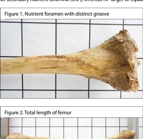 Figure 1 From Morphological And Topographical Anatomy Of Nutrient