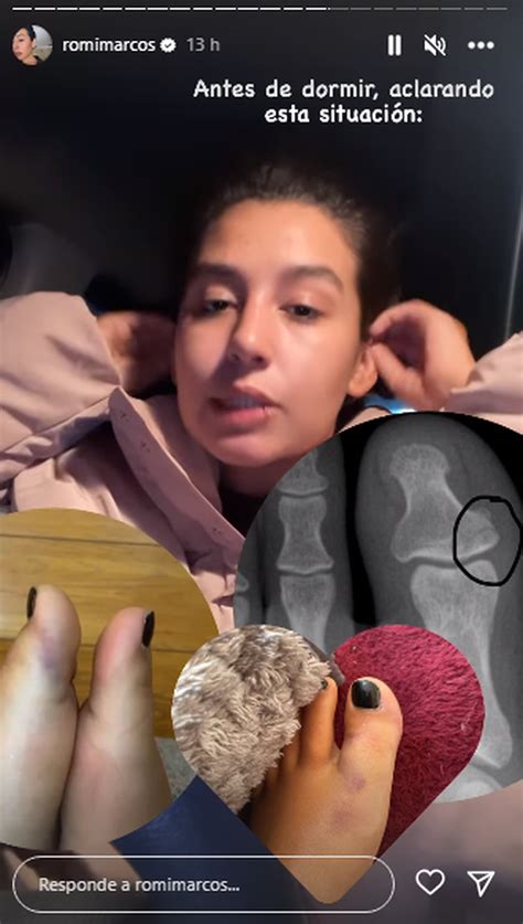 Romina Marcos, hija de Niurka, sufre accidente que la deja en silla de