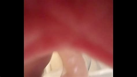 Extreme Insertion Anal Search XVIDEOS