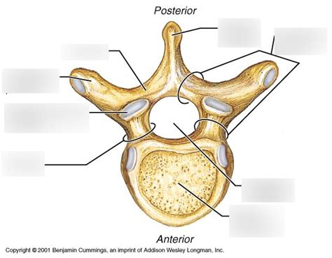 Neuroanatomy Workbook Arch Lamina Pedicle Body And Foramen Diagram