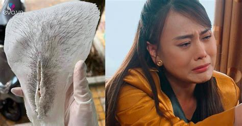 Khóc thét trước thành quả wax lông vùng bikini nhìn thôi đã thấy cô bé chịu nhiều tổn thương