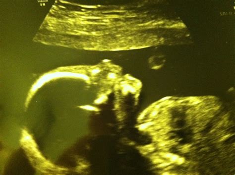 My Journey To Single Lesbian Motherhood