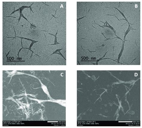 Transmission Electron Microscopy (TEM) and Scanning Transmission ... 