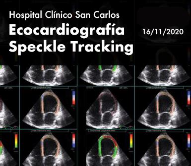 Ecocardiografía Speckle Tracking 16 noviembre 2020 Fundación FIC