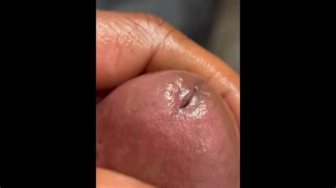 Admiring My Pretty With Cock Rings No Cum Pornhub Gay