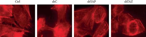 Knockdown Of Yap Or Taz Reduced Epithelial Mesenchymal Transition Emt