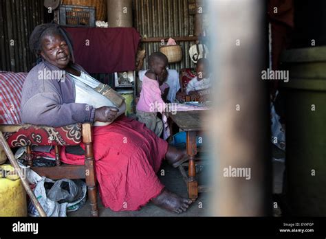 Severe Morbid Obesity Hi Res Stock Photography And Images Alamy