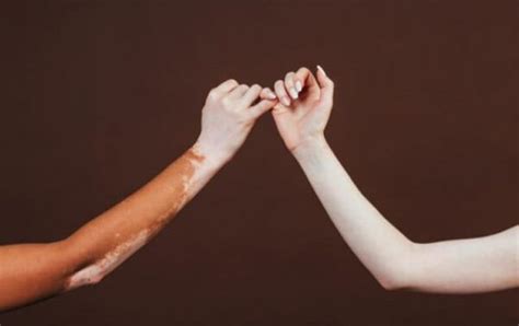 Melanismo Em Humanos - ¿Qué es el melanismo?