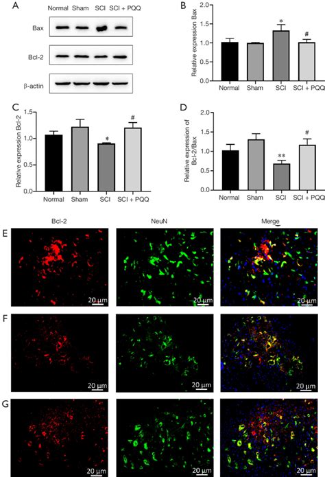 Expression change of Bcl-2, Bax and their co-localization with neurons ...