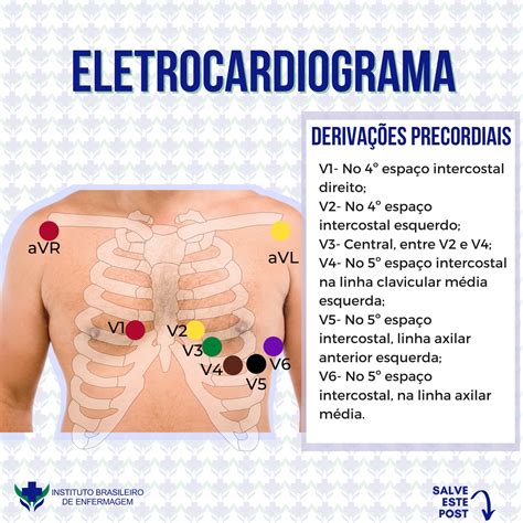 Ecg Posicionamento Dos Eletrodos