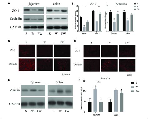 Intestinal Mucosal Tight Junction Proteins Expression Of Three