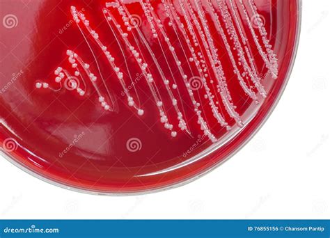 Streptocoque Colonies Bactériennes Avec Bêta Hémolytique Sur Sang AG