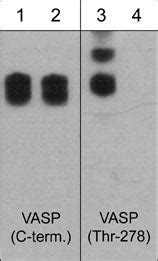 VASP Thr 278 Phospho Specific Antibody ECM Biosciences