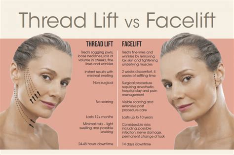 Facelift or Thread Lift?