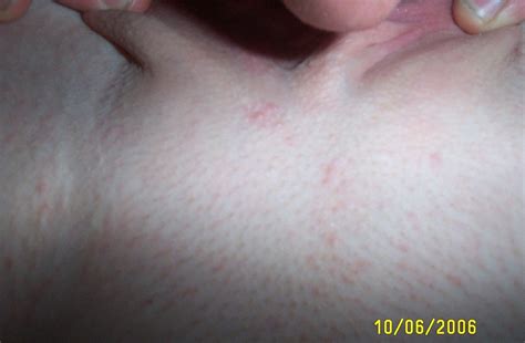 Amateur Photos Excitedpics Porn Pic