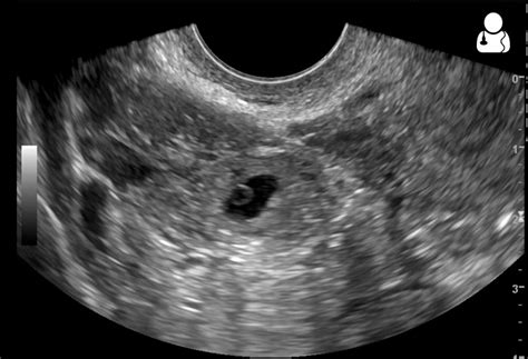 UOTW #61 - Core Ultrasound