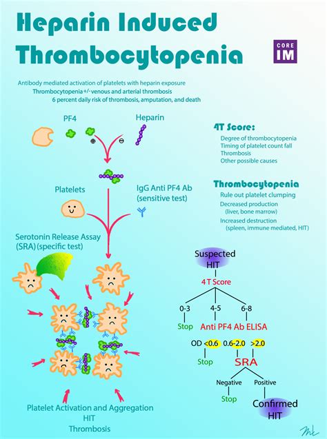 5 Pearls On Heparin Induced Thrombocytopenia Core Im Podcast