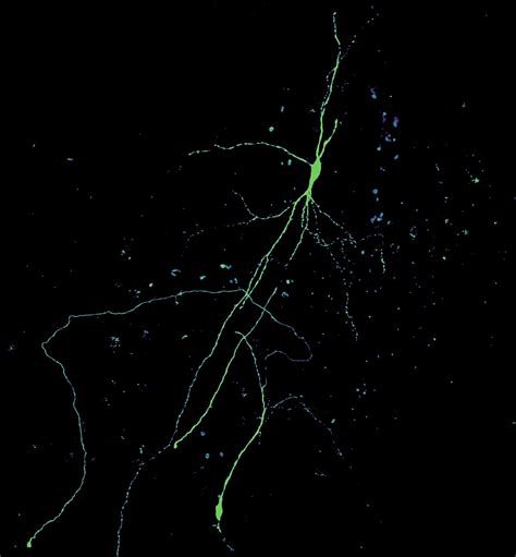Effects of Stress on Dopamine Circuit Structure and Function - Lerner Lab - Northwestern