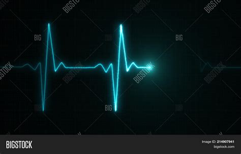 Cardiogram Cardiograph Image & Photo (Free Trial) | Bigstock