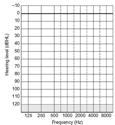 Blank Audiogram Template Download 6 Templates Example Templates