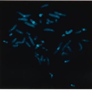 Genetics Of Sex Determination And Differentiation