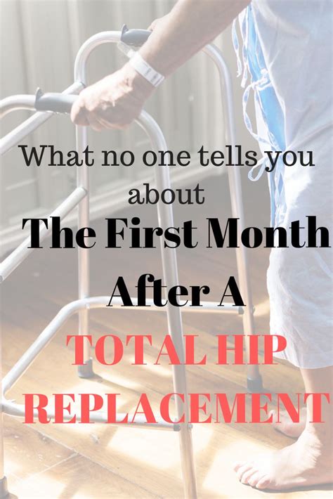 Recovery Time After Robotic Hip Replacement at Lee Porter blog