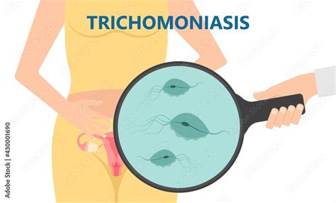 Douche Vagina Odor Clean Blood Flora Ectopic Yeast Bacterial Pelvic Genitals Swelling Pain Sex