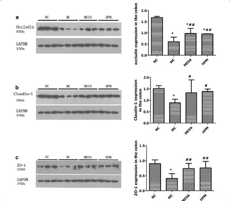 Expression Of Colonic Epithelial Tj Related Proteins Occludin